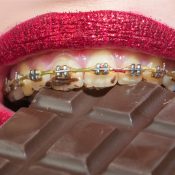 Things you can’t eat with braces