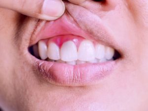 how to tell if your gums are healthy