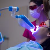 Professional Teeth Whitening Options
