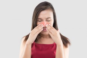 What does nasal vestibulitis look like?